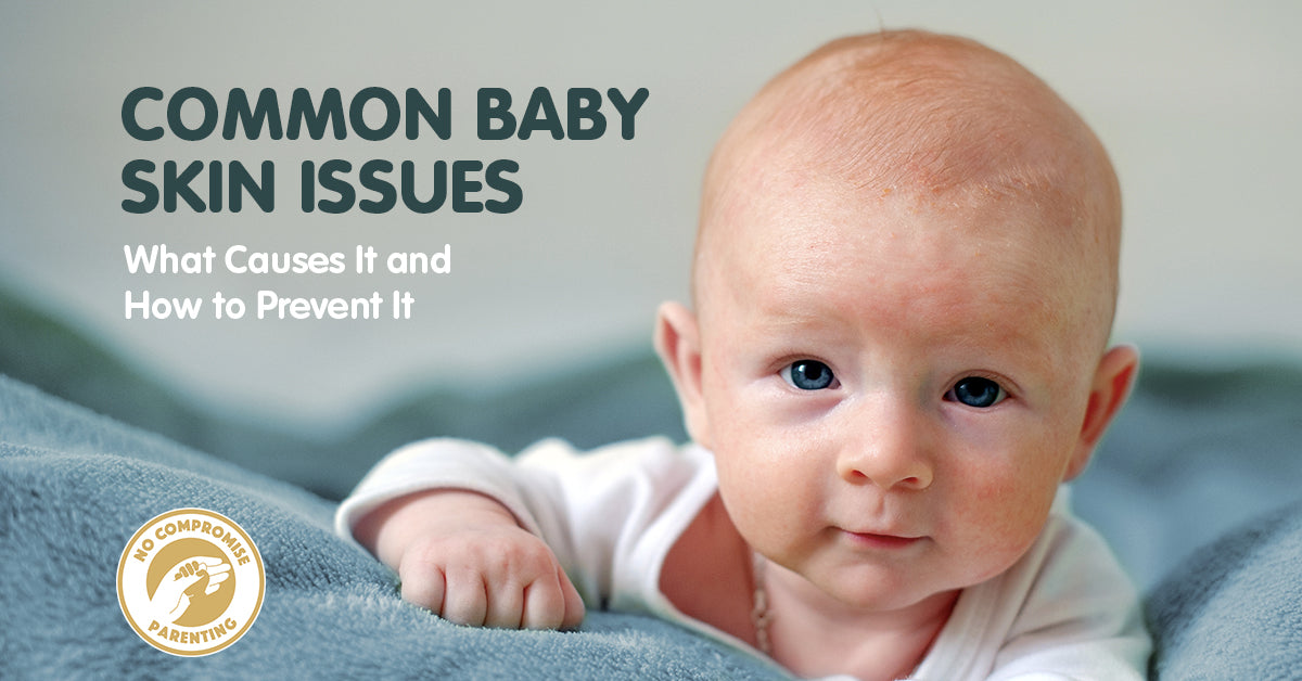 Common Newborn and Baby Skin Issues: What Causes It and How to Prevent It