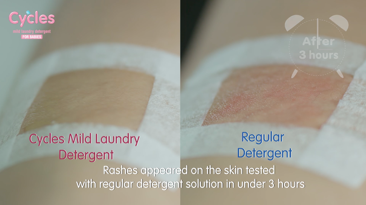 VIDEO: Cycles Mild Laundry Detergent Dermal Patch Test