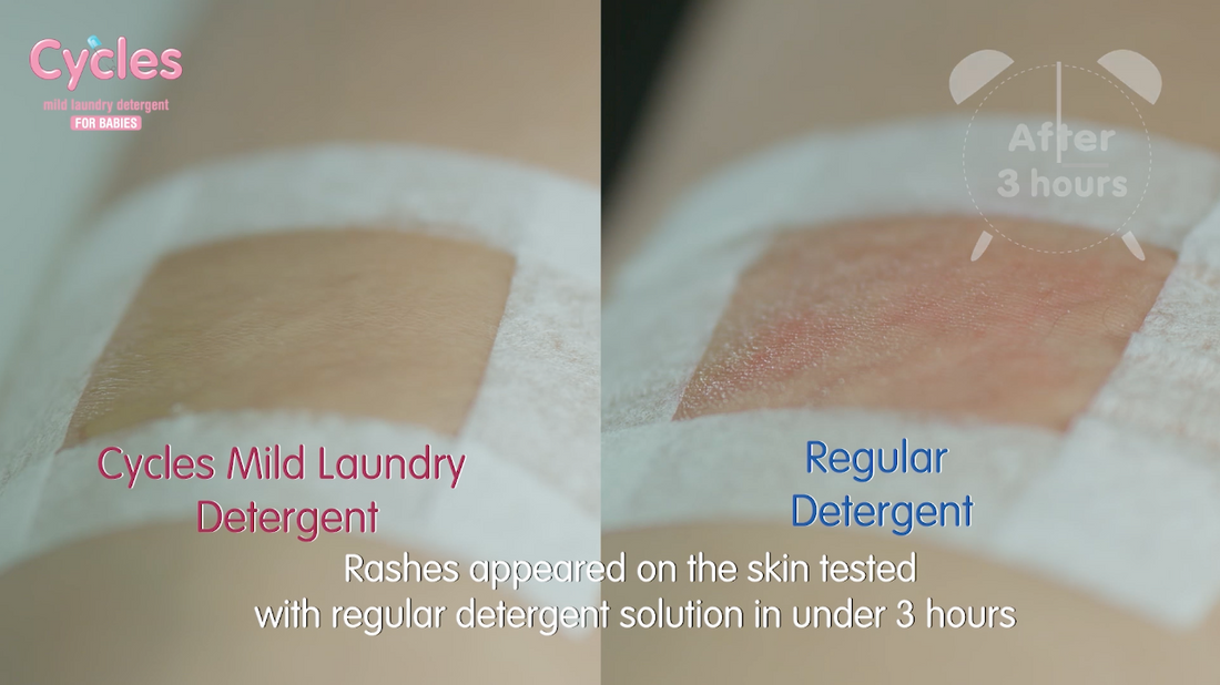 Dermal Patch Test - Cycles Mild Laundry Detergent for Babies